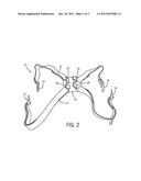 SUPPORT SYSTEM FOR SURGICAL INSTRUMENT diagram and image