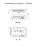 SYSTEMS AND METHODS FOR REPLACING SIGNAL ARTIFACTS IN A GLUCOSE SENSOR     DATA STREAM diagram and image