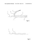 APPLICATOR FOR APPLYING AN ARTICLE TO THE SKIN diagram and image