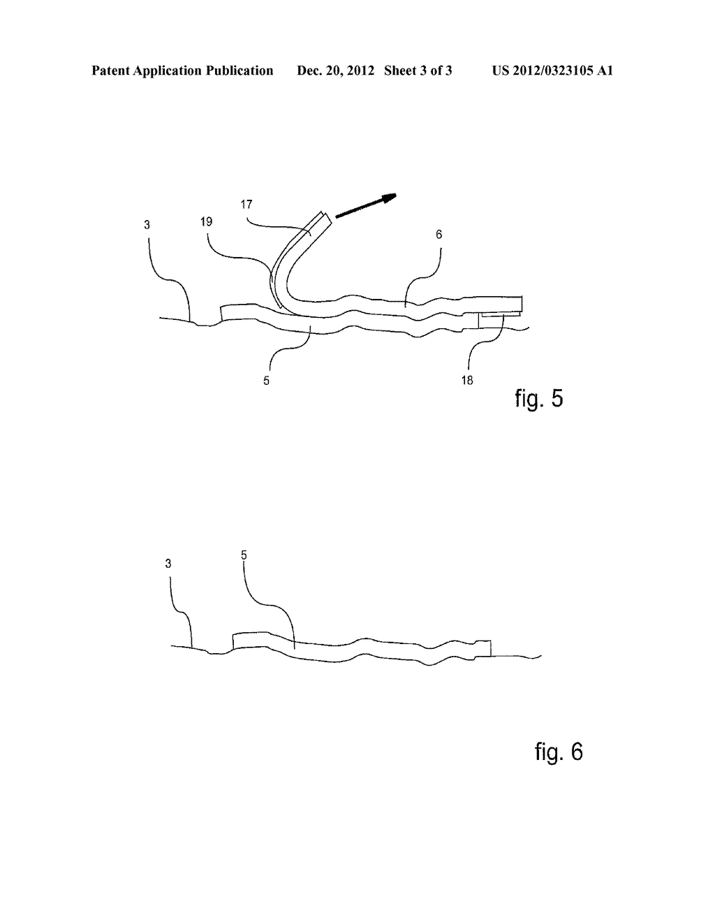 APPLICATOR FOR APPLYING AN ARTICLE TO THE SKIN - diagram, schematic, and image 04