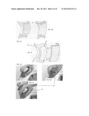 COMPRESSION DEVICE diagram and image