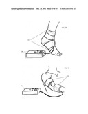 COMPRESSION DEVICE diagram and image