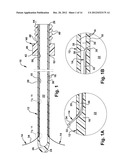 CATHETER ASSEMBLY diagram and image