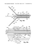 CATHETER ASSEMBLY diagram and image