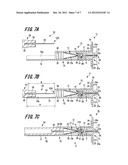 INJECTION NEEDLE ASSEMBLY AND DRUG INJECTION APPARATUS diagram and image