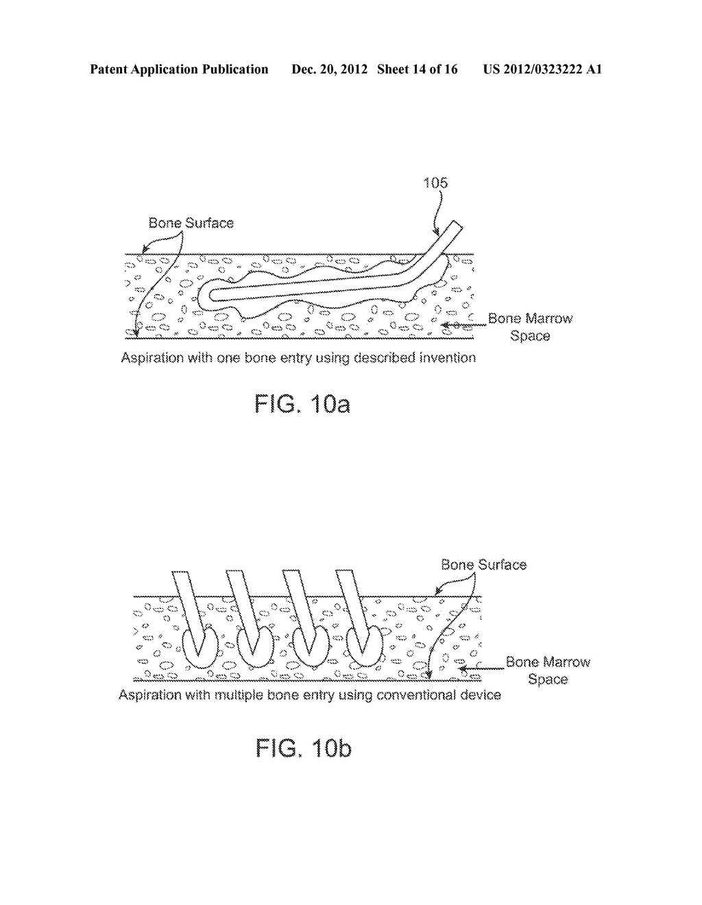 DEVICE AND METHOD FOR RAPID ASPIRATION AND COLLECTION OF BODY TISSUE FROM     WITHIN AN ENCLOSED BODY SPACE - diagram, schematic, and image 15