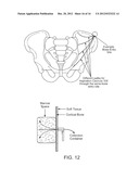 DEVICE AND METHOD FOR RAPID ASPIRATION AND COLLECTION OF BODY TISSUE FROM     WITHIN AN ENCLOSED BODY SPACE diagram and image