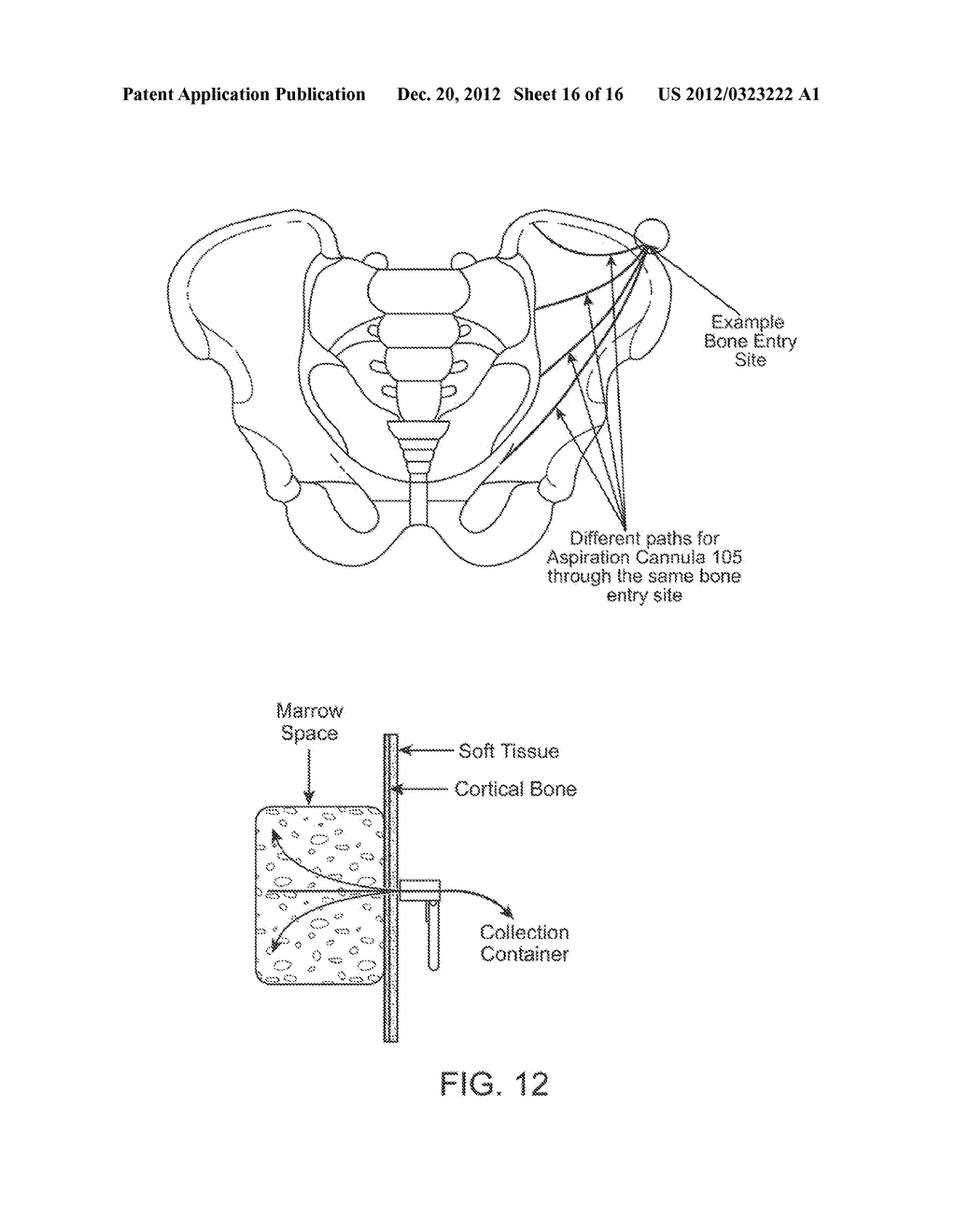 DEVICE AND METHOD FOR RAPID ASPIRATION AND COLLECTION OF BODY TISSUE FROM     WITHIN AN ENCLOSED BODY SPACE - diagram, schematic, and image 17