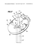 SURGICAL SYSTEM AND CONTROL PROCESS FOR A SURGICAL INSTRUMENT AND PROCESS     FOR CONNECTING BODILY TISSUES diagram and image