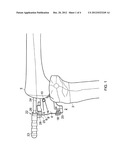 DRILL GUIDE diagram and image