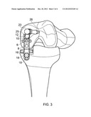 DRILL GUIDE diagram and image