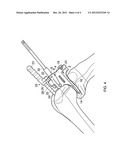 DRILL GUIDE diagram and image