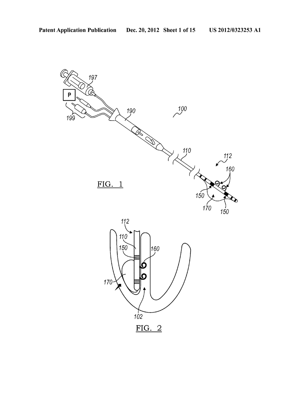 DEVICE AND METHOD FOR POSITIONING AN ELECTRODE IN TISSUE - diagram, schematic, and image 02