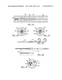 DEVICE AND METHOD FOR POSITIONING AN ELECTRODE IN TISSUE diagram and image