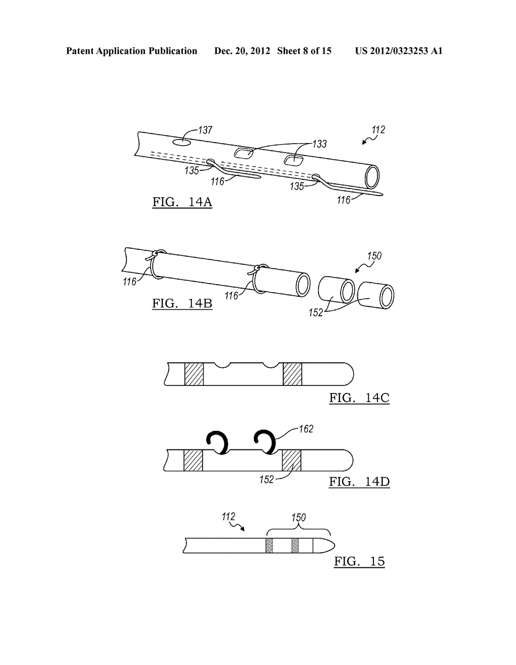 DEVICE AND METHOD FOR POSITIONING AN ELECTRODE IN TISSUE - diagram, schematic, and image 09