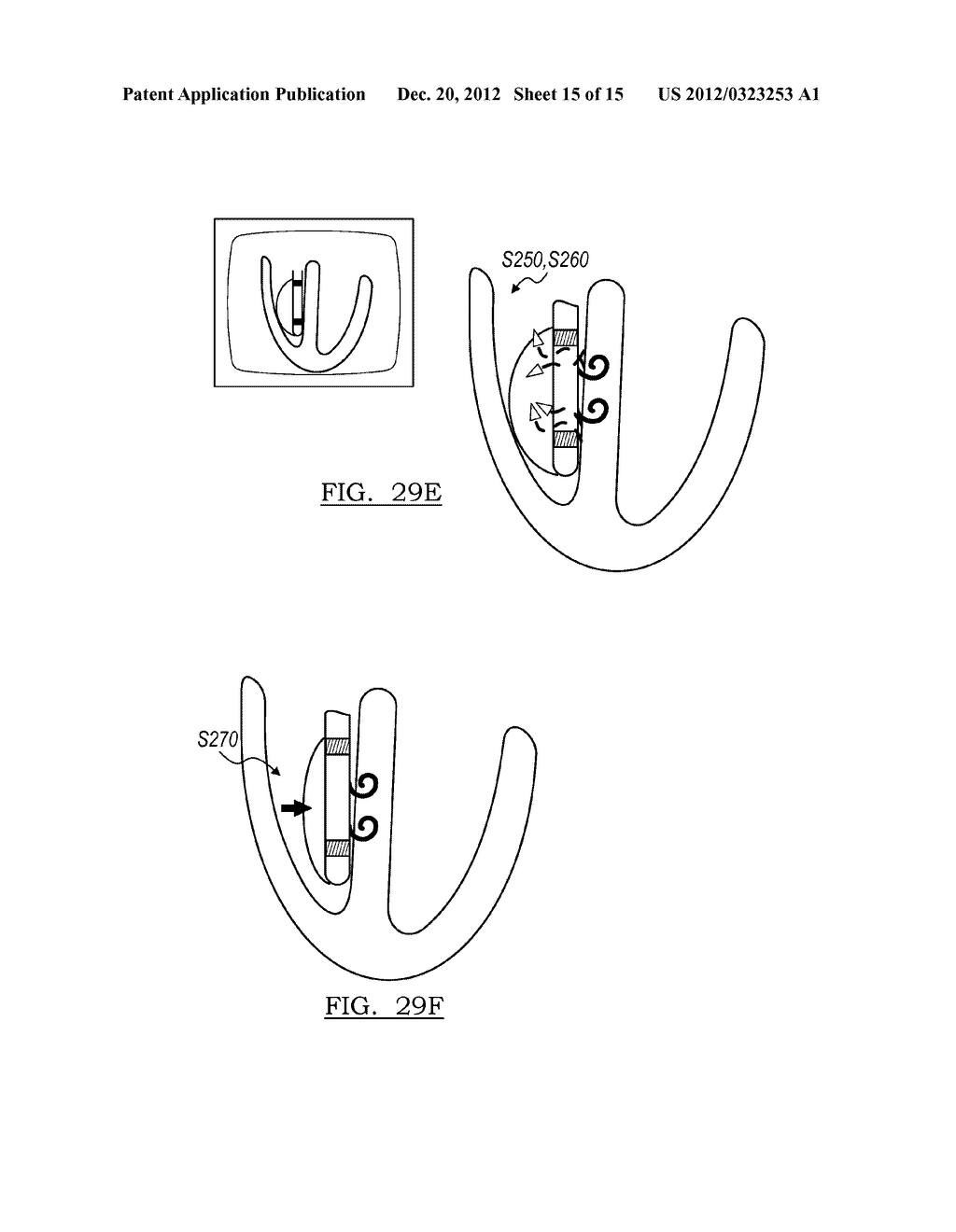 DEVICE AND METHOD FOR POSITIONING AN ELECTRODE IN TISSUE - diagram, schematic, and image 16