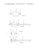 LUMEN REENTRY DEVICES AND METHODS diagram and image