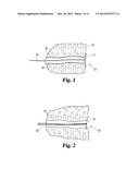 FISTULA CLOSURE DEVICES AND METHODS diagram and image