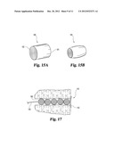 FISTULA CLOSURE DEVICES AND METHODS diagram and image