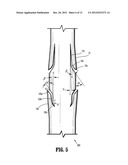 Compound Barb Medical Device and Method diagram and image