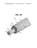 HIGH STRENGTH SUTURE WITH ABSORBABLE CORE AND SUTURE ANCHOR COMBINATION diagram and image