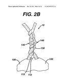 HIGH STRENGTH SUTURE WITH ABSORBABLE CORE AND SUTURE ANCHOR COMBINATION diagram and image