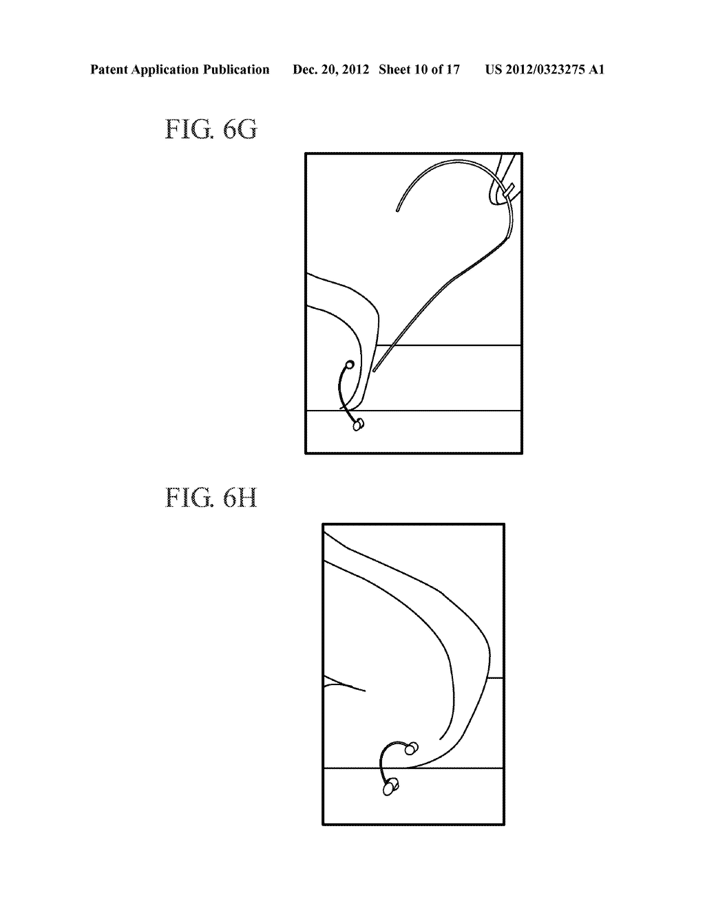 METHOD AND DEVICE FOR APPROXIMATING TISSUE - diagram, schematic, and image 11
