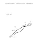 METHOD AND DEVICE FOR APPROXIMATING TISSUE diagram and image