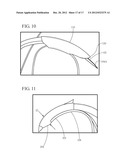 METHOD AND DEVICE FOR APPROXIMATING TISSUE diagram and image