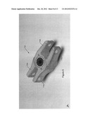 EXPANDABLE INTERSPINOUS DEVICE diagram and image