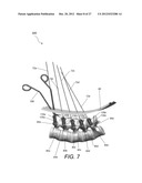 METHODS, TOOLS AND DEVICES FOR SPINAL FIXATION diagram and image