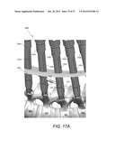 METHODS, TOOLS AND DEVICES FOR SPINAL FIXATION diagram and image