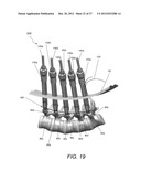 METHODS, TOOLS AND DEVICES FOR SPINAL FIXATION diagram and image