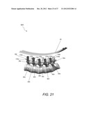 METHODS, TOOLS AND DEVICES FOR SPINAL FIXATION diagram and image