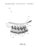 METHODS, TOOLS AND DEVICES FOR SPINAL FIXATION diagram and image