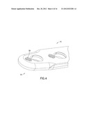 Method of Implanting a Modular Fracture Fixation System diagram and image