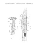 Method of Implanting a Modular Fracture Fixation System diagram and image