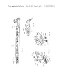 Method of Implanting a Modular Fracture Fixation System diagram and image