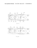 Method of Implanting a Modular Fracture Fixation System diagram and image