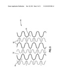 Coatings for Medical Devices Comprising a Therapeutic Agent and a     Metallic Material diagram and image