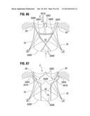 PROSTHETIC APPARATUS FOR IMPLANTATION AT MITRAL VALVE diagram and image