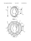 ADJUSTABLE INTRAOCULAR LENS diagram and image