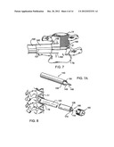 SPINAL IMPLANT AND INSTRUMENTS diagram and image