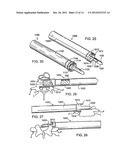 SPINAL IMPLANT AND INSTRUMENTS diagram and image