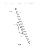 PORTABLE ELECTRONIC DEVICE CASE ACCESSORIES AND RELATED SYSTEMS AND     METHODS diagram and image