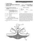 TISSUE FASTENERS AND RELATED INSERTION DEVICES, MECHANISMS, AND METHODS diagram and image