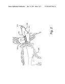 INFLATABLE MEMBRANE HAVING NON-UNIFORM INFLATION CHARACTERISTIC diagram and image