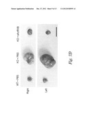 VARIANT ACTIVIN RECEPTOR POLYPEPTIDES AND USES THEREOF diagram and image