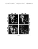 Therapeutic Applications Targeting SARM1 diagram and image