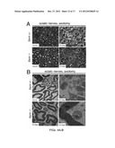 Therapeutic Applications Targeting SARM1 diagram and image